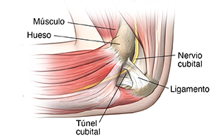 Vista lateral interna de un codo donde se observan los músculos del antebrazo y el nervio cubital dentro del túnel cubital.