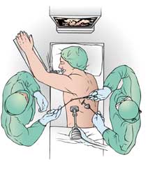 Thoracotomy: One way for doctors to get a lung biopsy. thoracotomy
