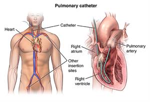 PCardio_20140403_v0_004