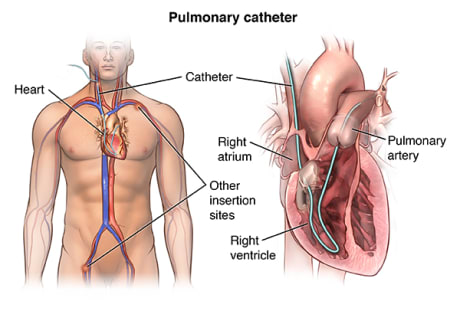 PCardio_20140403_v0_004