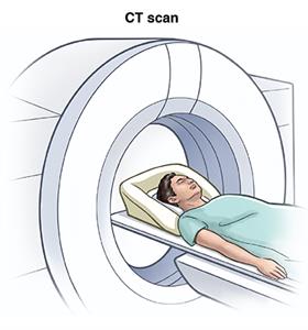 Person lying in CT scanner.